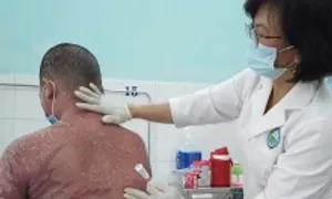 Vảy nến - bệnh gây nỗi đau thể xác lẫn tinh thần Vảy nến - bệnh gây nỗi đau thể xác lẫn tinh thần
